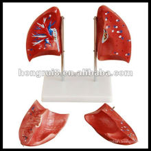 ISO 2012 Human Lung Anatomy Modelo HR-321